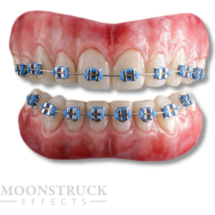 Moonstruck Effects Anwen ProFX Teeth With Blue Braces