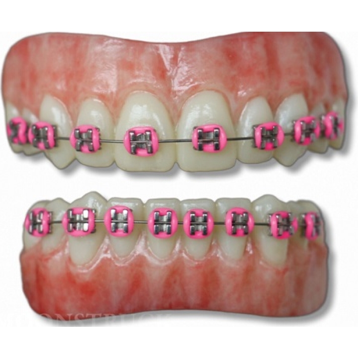 Moonstruck Effects Anwen ProFX Teeth With Pink Braces