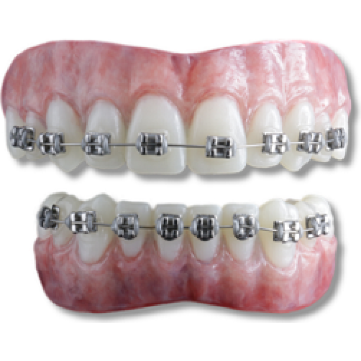 Moonstruck Effects Anwen ProFX Teeth With Silver Braces