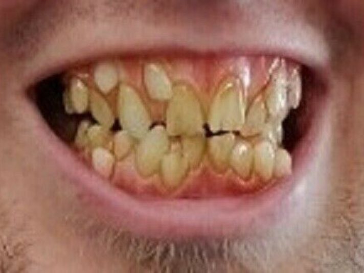 Moonstruck Effects Mormo ProFX Teeth