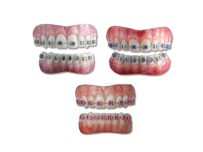 Moonstruck Effects Anwen ProFX Teeth With Blue Braces