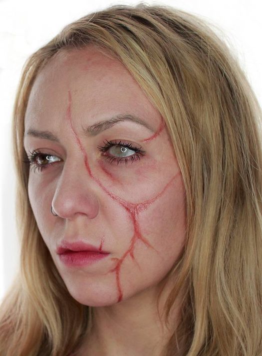 Rigid Collodion Scar Fluid 12 ml